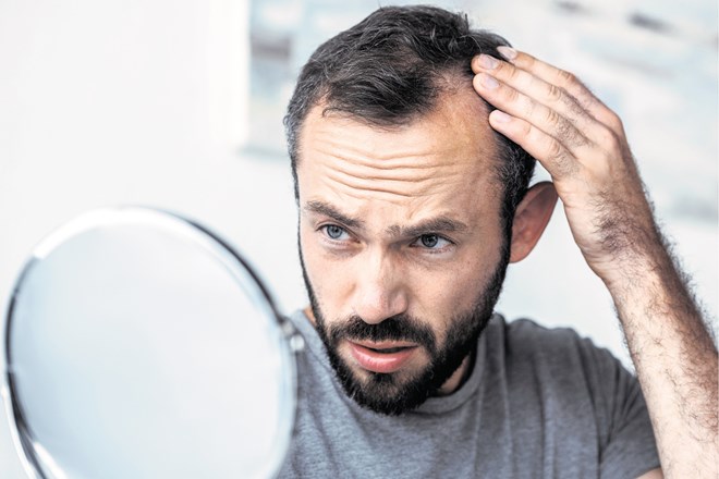 Marsikdo je že doživel tak zaskrbljen pogled. iStock